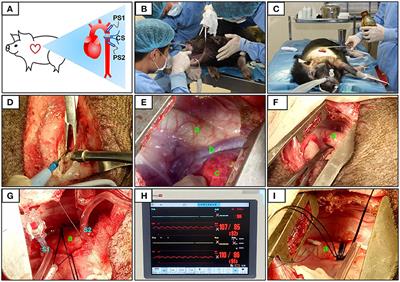 A Porcine Model of Heart Failure With Preserved Ejection Fraction Induced by Chronic Pressure Overload Characterized by Cardiac Fibrosis and Remodeling